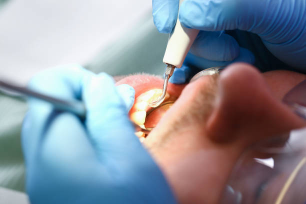 Best Pediatric Emergency Dentist in Nassau Village Ratliff, FL